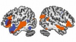Neural imaging, W. Marslen-Wilson and L. Tyler